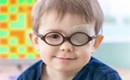 تنبلی چشم (Amblyopia)-8 بهمن 1403